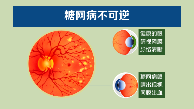 揭秘6000万中国人可能有效失明的真相