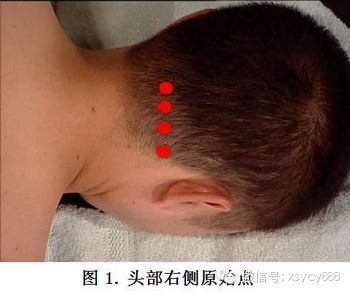 台湾张钊汉原始点按摩手法全集及介绍