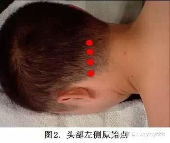 台湾张钊汉原始点按摩手法全集及介绍