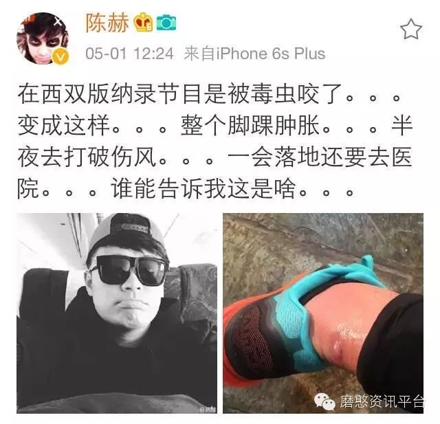 夏季警惕蚊虫丨陈赫西双版纳录节目不幸被毒虫咬伤 白脚踝...