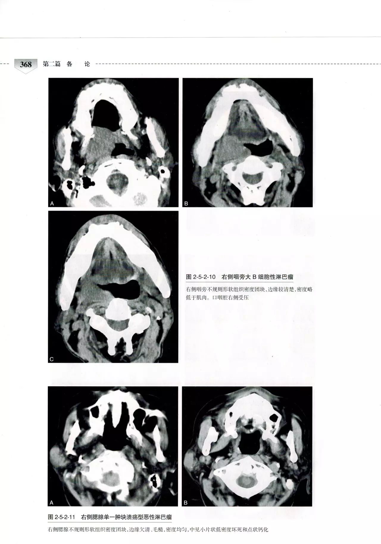 人卫社口腔颌面部ct诊断学——孟存芳