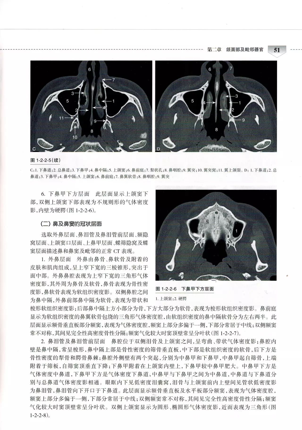 人卫社口腔颌面部ct诊断学——孟存芳