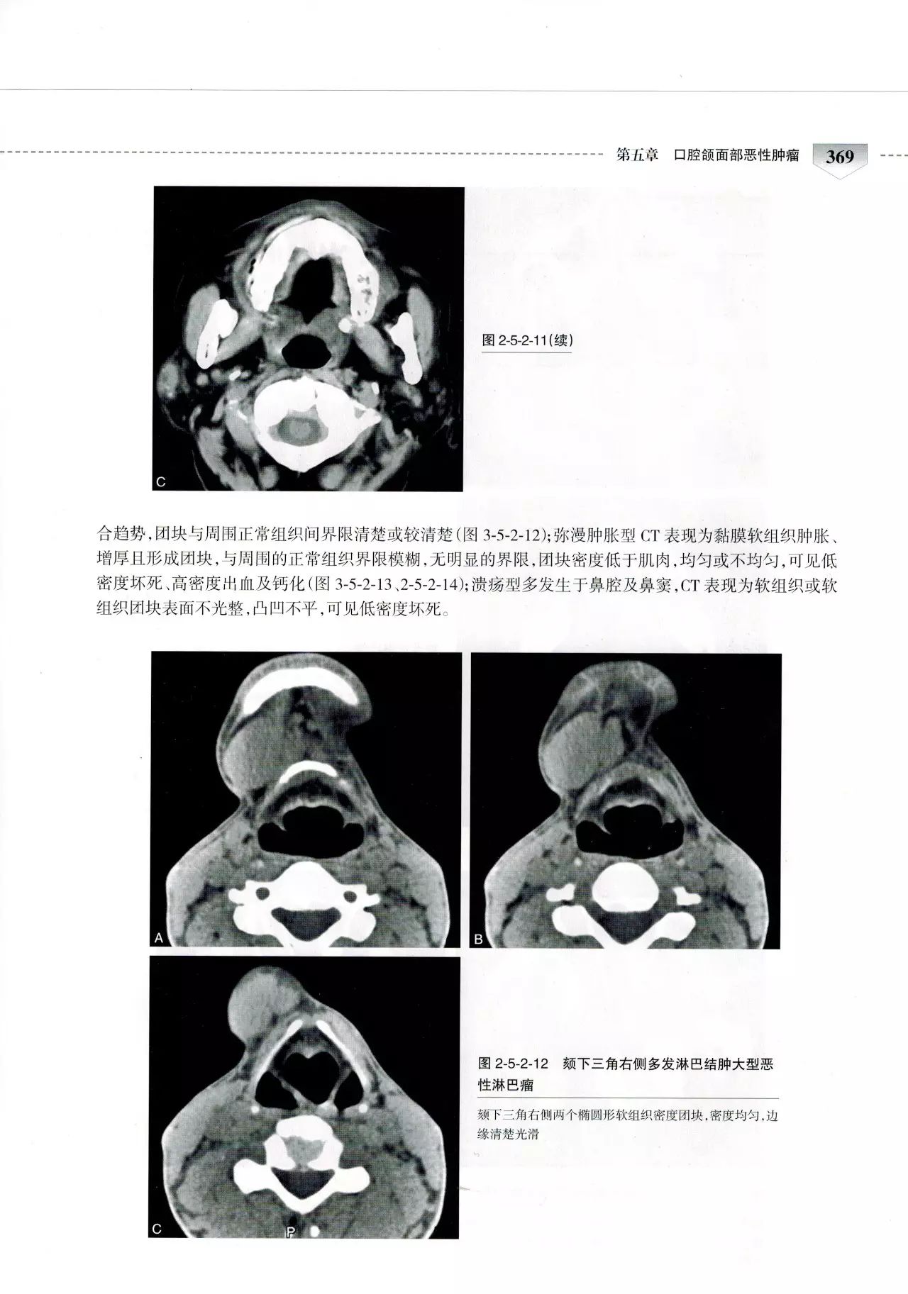 人卫社口腔颌面部ct诊断学——孟存芳