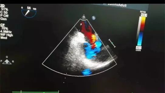 怀孕时被查出患先天性心脏病!我院心外科用精湛医技为患者解除病患 重获新生-怀孕期