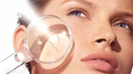 红血丝怎么修复？