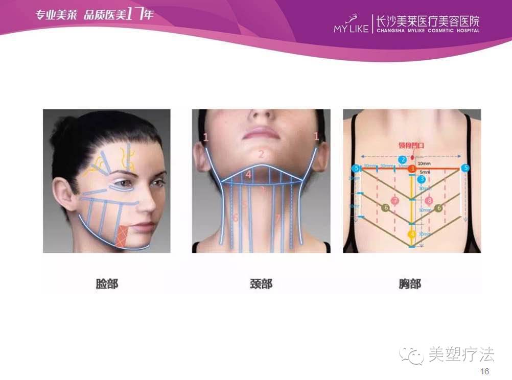 微针第七期超声刀的操作术后反应及联合微针的治疗