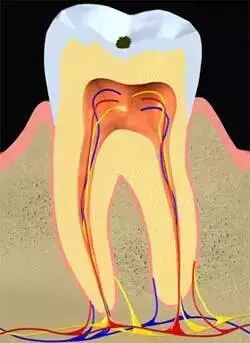 牙齿有多“黑”，会吞掉你上万块钱！