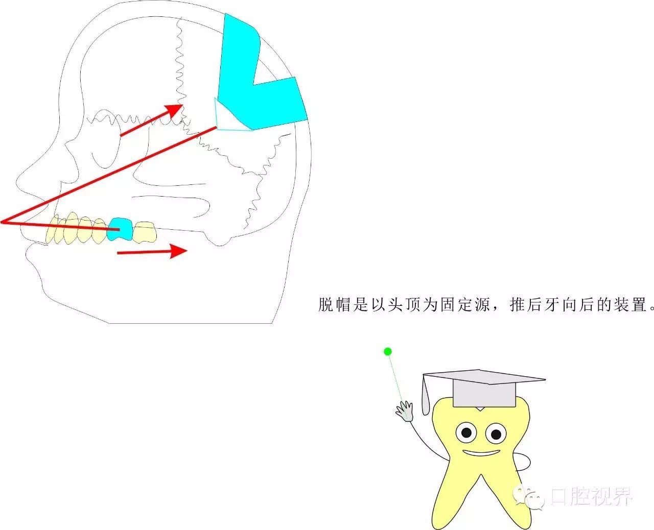 答:弓丝同托槽一样,都是正畸治疗中必不可少的东西.