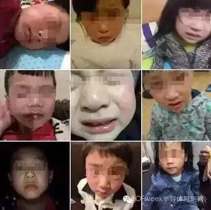 学校误开紫外灯致20个孩子眼灼伤，安全用灯需注意哪些？