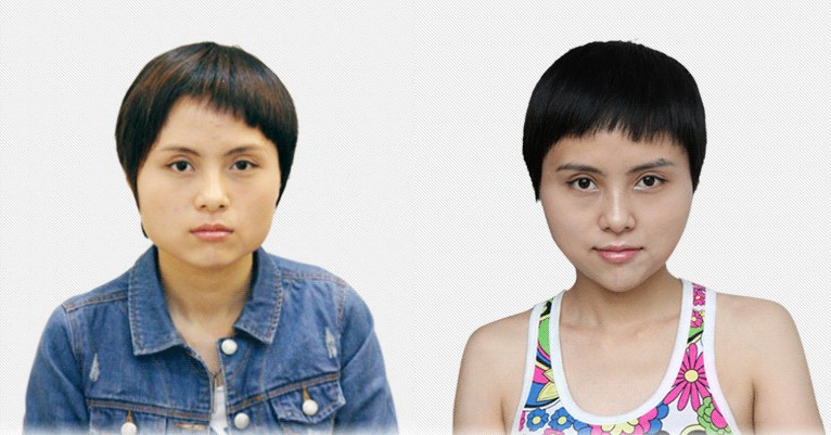 【东韩整形实力】看方脸晶晶的真实蜕变之路!