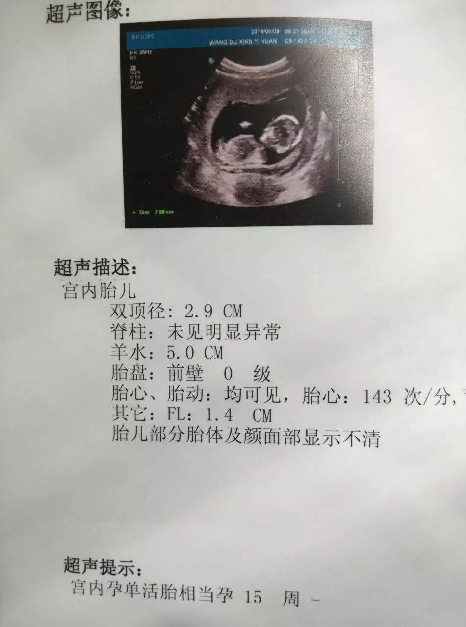 帮忙看看孕14周b超图是男孩还是女孩啊 谢谢 育儿问答 宝宝树