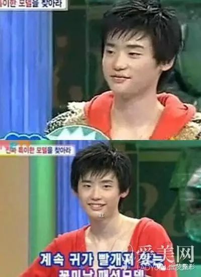 李钟硕整容前丑到哭 朴信惠出道11年依旧童颜