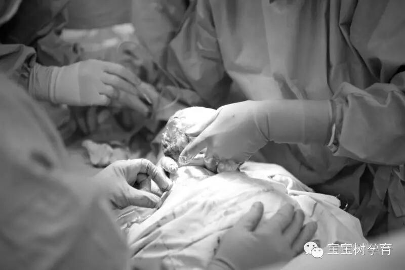 记录我怀孕生产的心酸历程,宝妈们也了解一下胎盘早剥的危险性!-怀孕期