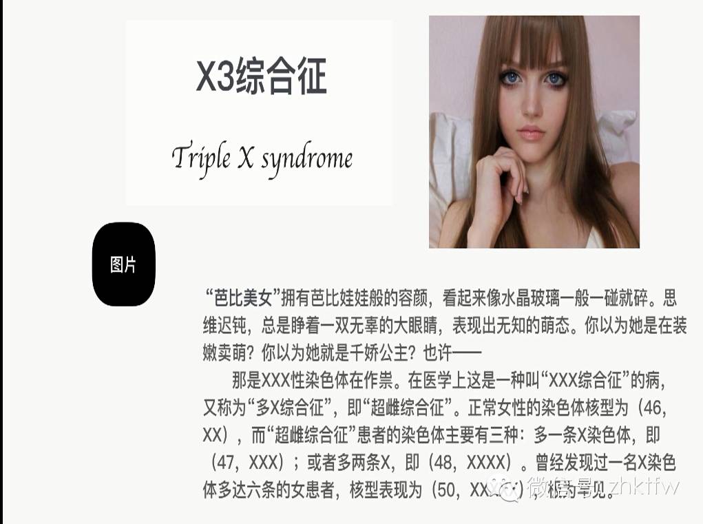 xxx综合征也称为"x3综合征"或"超雌综合征".