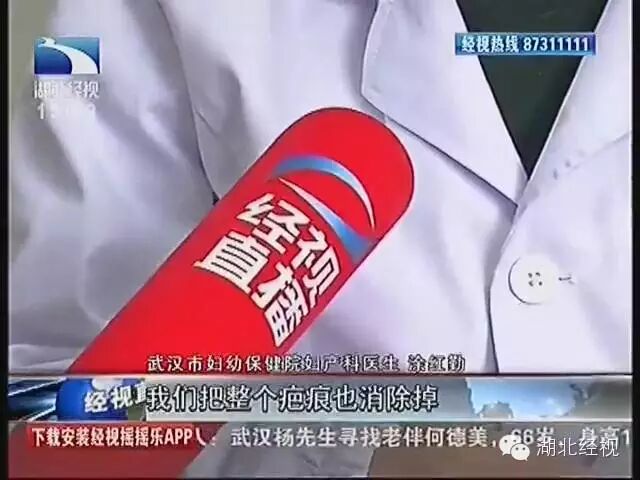 怀二胎时“刀疤”撑不住 武汉准妈妈无奈流产 《经视直播》-怀孕期