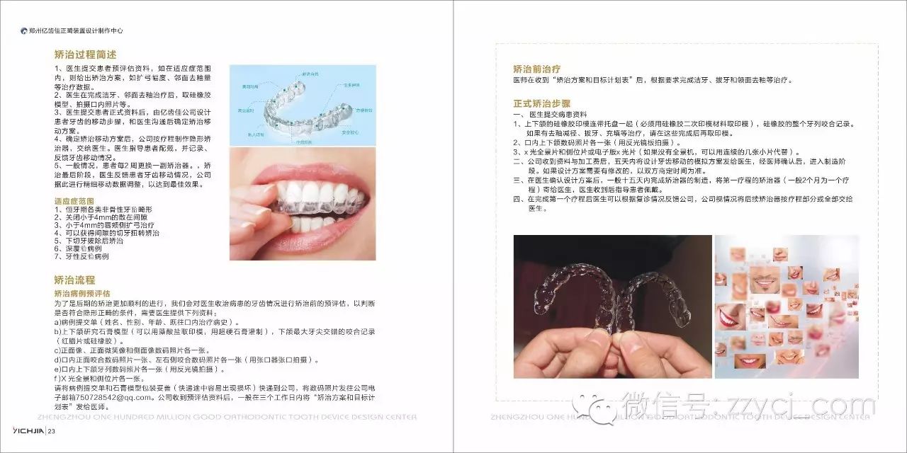 亿齿佳定制式活动矫治器图谱(带详解)