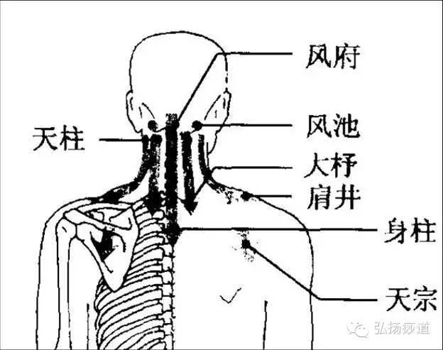 颈椎病的刮痧方法