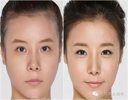 年轻可爱的秘诀—发际线