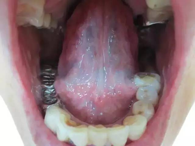 http://7xo6kd.com1.z0.glb.clouddn.com/upload-ueditor-image-20160614-1465876051345092965.jpg