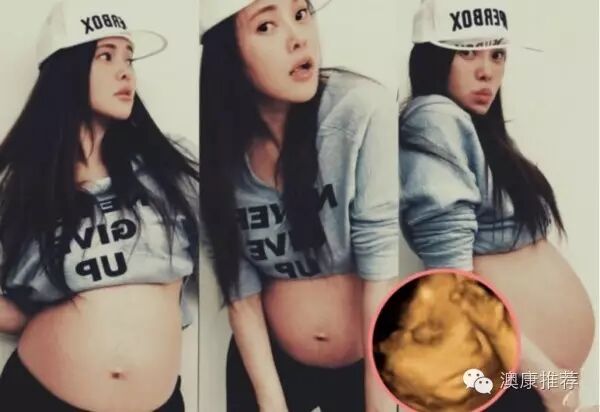 产后母乳不顺畅?伊能静微博推荐卵磷脂,宝宝拒喝“石头...