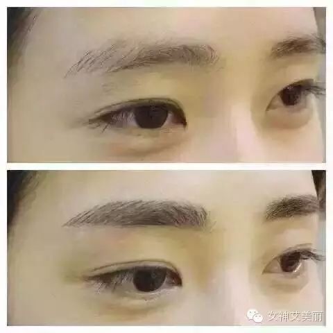 赵丽颖:雾眉+美瞳线+发际线+水晶唇=素颜女神!