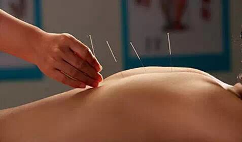 大艾灸案：一次针灸并用治愈高血压的特效案例