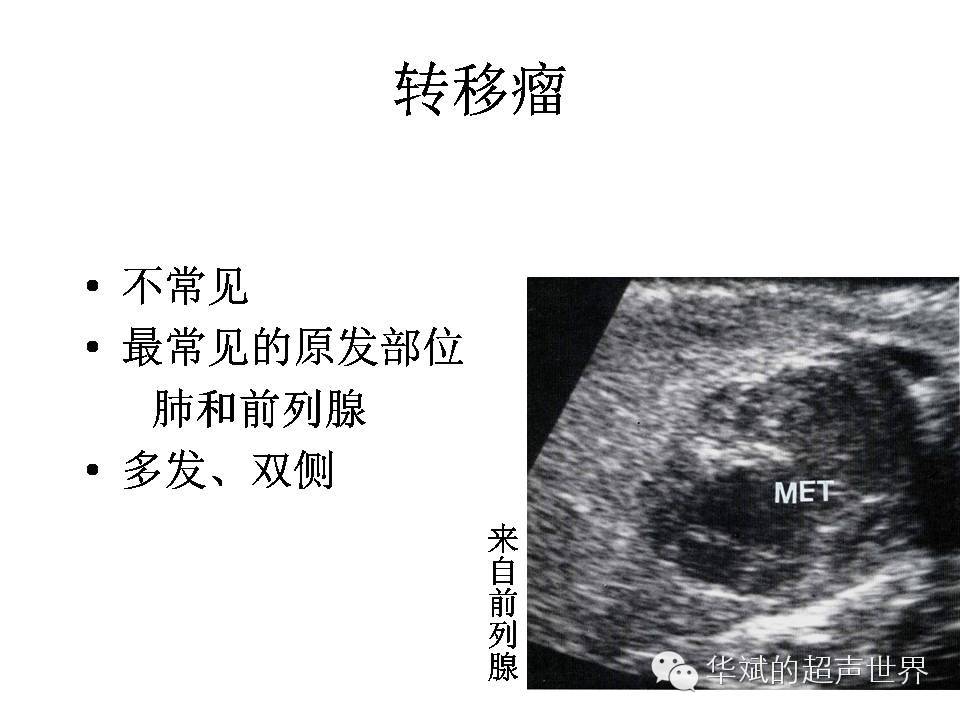 [转载]阴囊包块