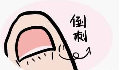 藏在孩子指甲上的惊人小秘密！绝大多数家长竟然不知道！
