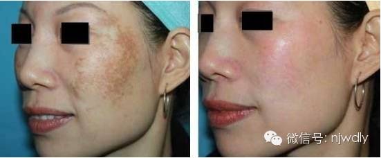 二胎政策开放,但有近半数人不愿生,哪些原因影响二胎到来?-怀孕期