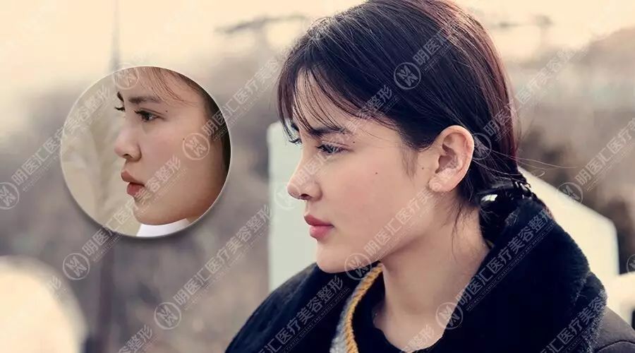 “伴郎专业户”杜淳自曝想娶宋慧乔 韩女星哪里最有魅力?