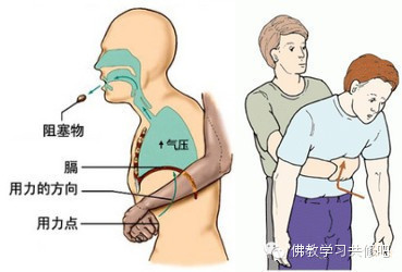 食物卡喉千万别拍背部!救了100多万人性命的“海姆立克急救法” 食物卡喉千万别拍背部!救了100多万人性命的“海姆立克急救法”