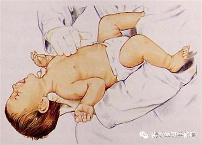 食物卡喉千万别拍背部!救了100多万人性命的“海姆立克急救法”