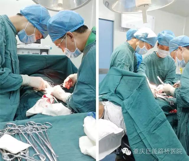 【疝气手术】7旬老人双侧腹股沟疝气手术案例