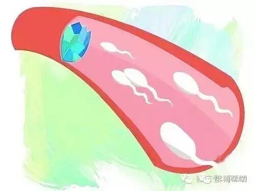 射在外面也有可能怀孕?只要精子质量足够健康-怀孕期