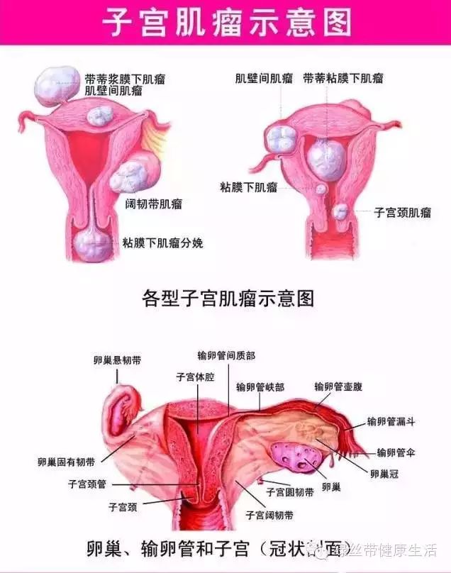 首页 我的资讯  如果你生完孩子后还长期痛经,那你子宫肌瘤是跑不了的