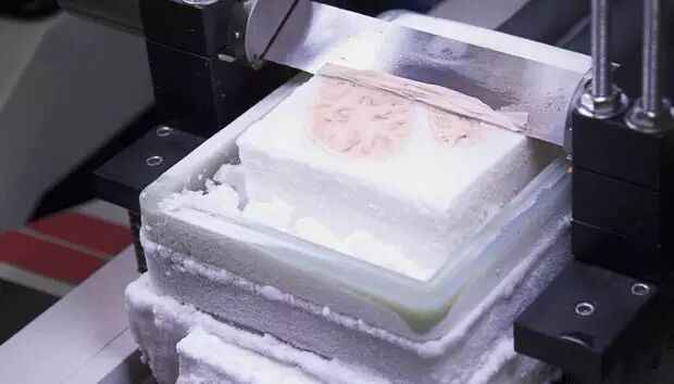 被安置在冰盒内的莫莱森大脑,被切割为2401片70微米厚的薄皮