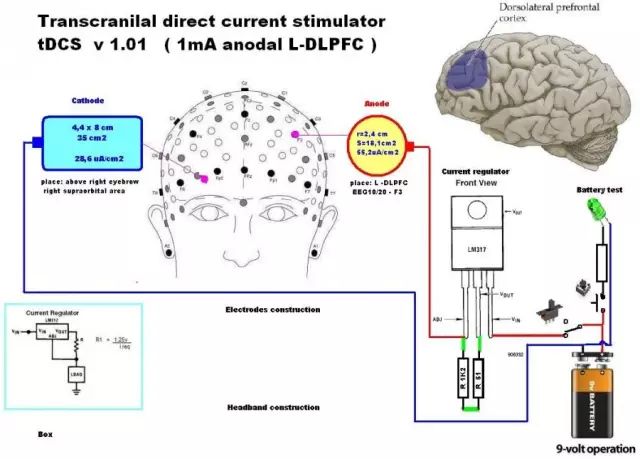 tDCS(经颅方向电流刺激)