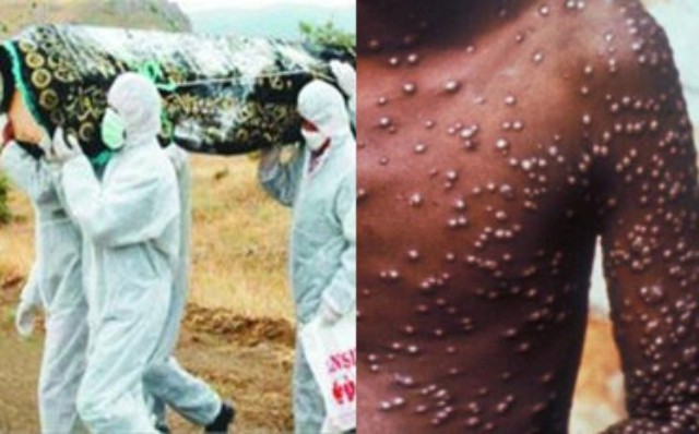 中国首现埃博拉病毒疑似病例 病毒最高致死率达90%
