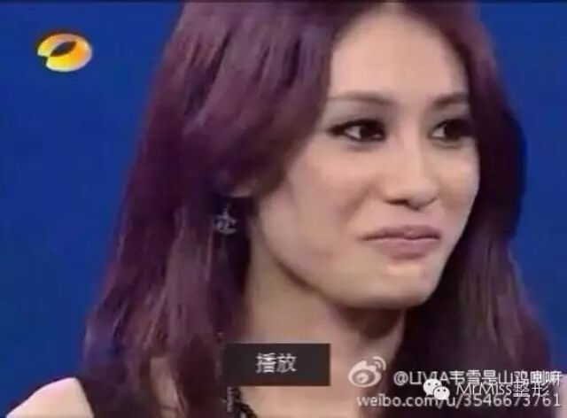 【第二扒】揭露网红整容:刘羽琦、潘奕、施薇靓......