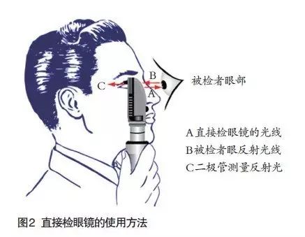 直接眼底镜的正确使用