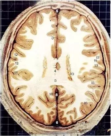 颅脑断层解剖图这些才是经典