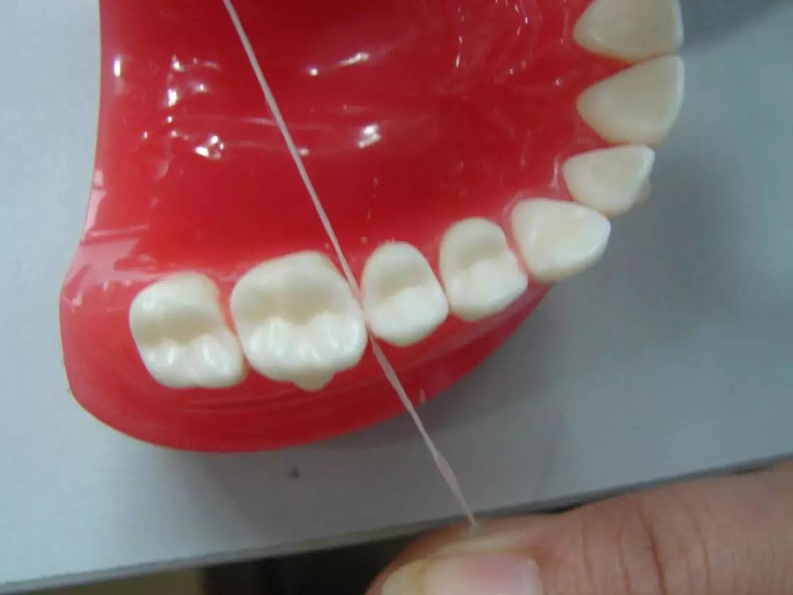 牙齿蛀了怎么办？要治疗么？ – OMF Surgeon's Notebook