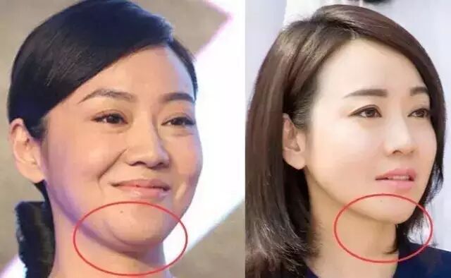 闫妮首度承认整容 网友的吐槽也是…没谁了…
