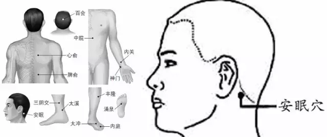 湖南針灸理療培訓(xùn)班失眠按摩療法