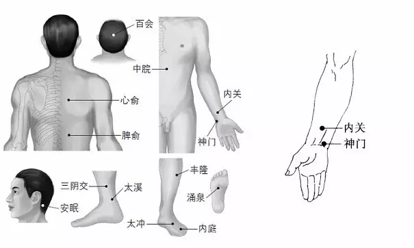 湖南針灸理療培訓(xùn)班失眠按摩療法