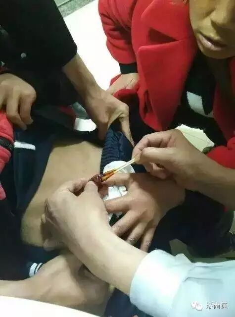 一小学老师体罚8岁男童！把娃下面打成了这模样！！转 <wbr>死 <wbr>她！！