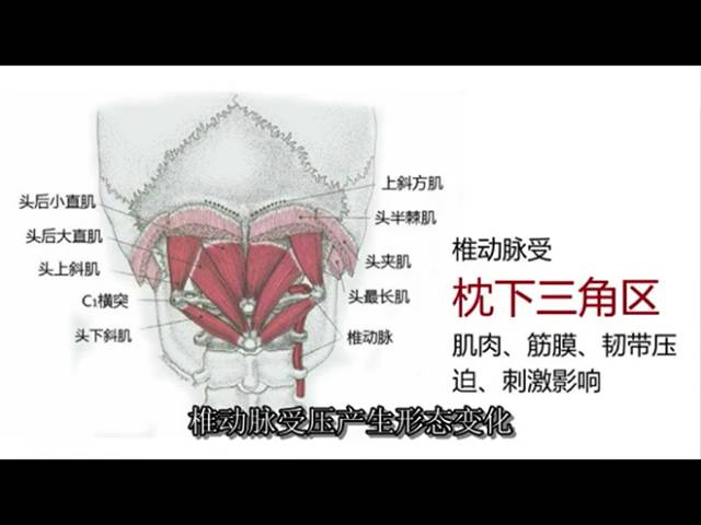 枕大神经从第三颈椎下缘出来,通过枕下三角区(也就是风池穴的位置)