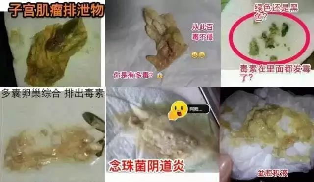 上面的东西,就是从一般女性子宫里排出来的脏东西,分别是第一次,第二