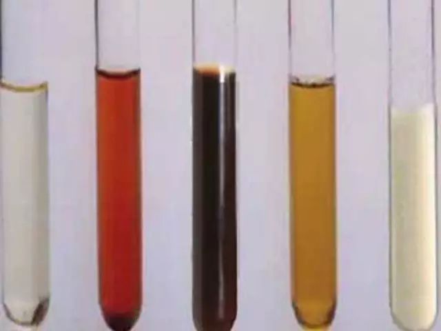 4种尿液颜色告诉你健康危机(转)