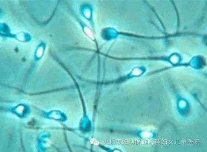什么是精子不液化?为什么会影响怀孕-怀孕期